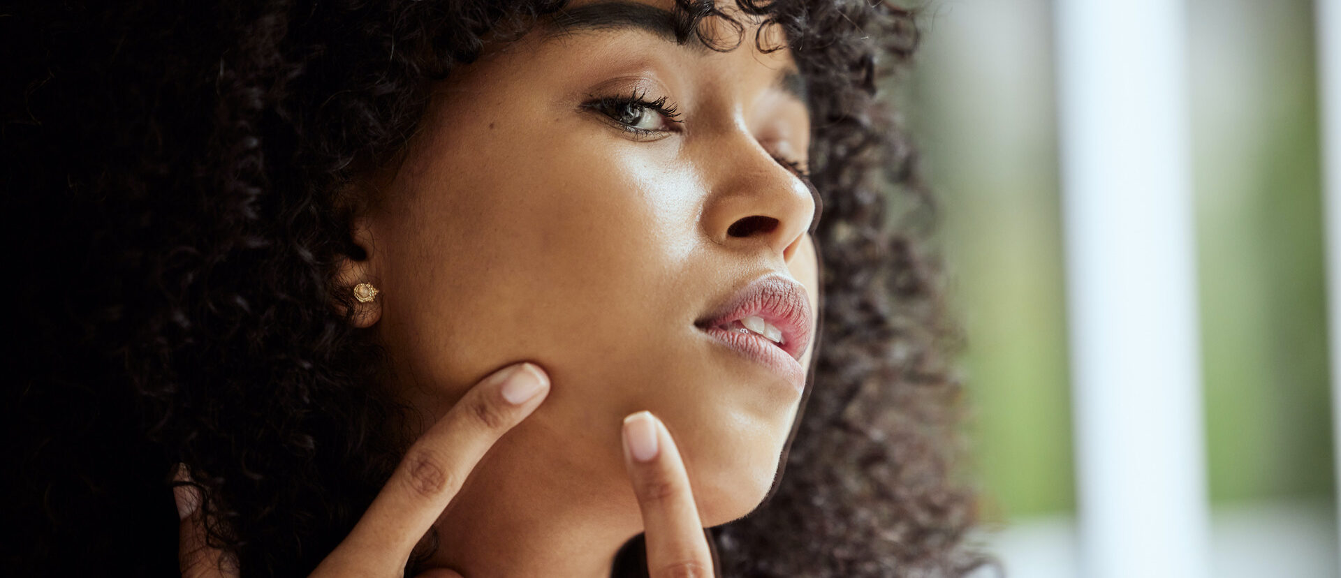 Acne & Acne Scars
