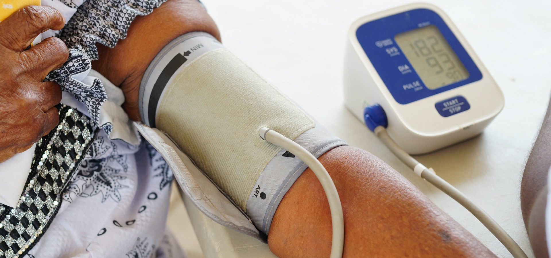 Hypertension