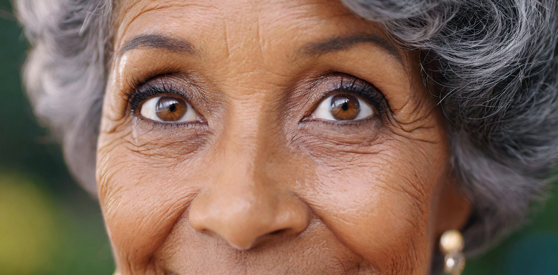 Wrinkles & Fine Lines